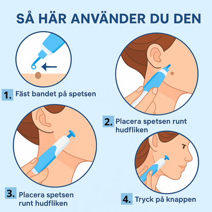 Flikfri- Frihet Från Hudflikar På Bara 3–14 Dagar