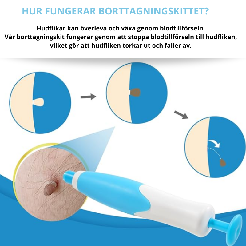Flikfri- Frihet Från Hudflikar På Bara 3–14 Dagar